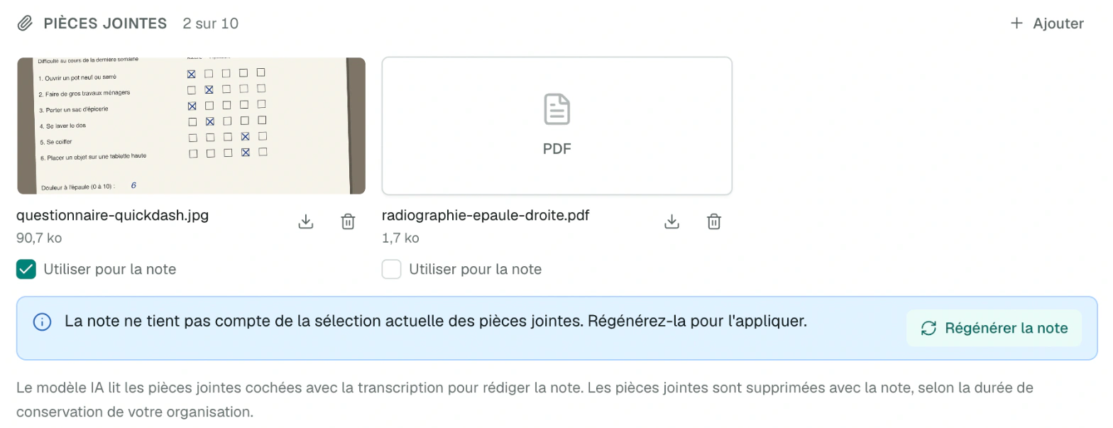 Une pièce jointe décochée après la note Bandeau qui propose de régénérer la note après un changement de sélection